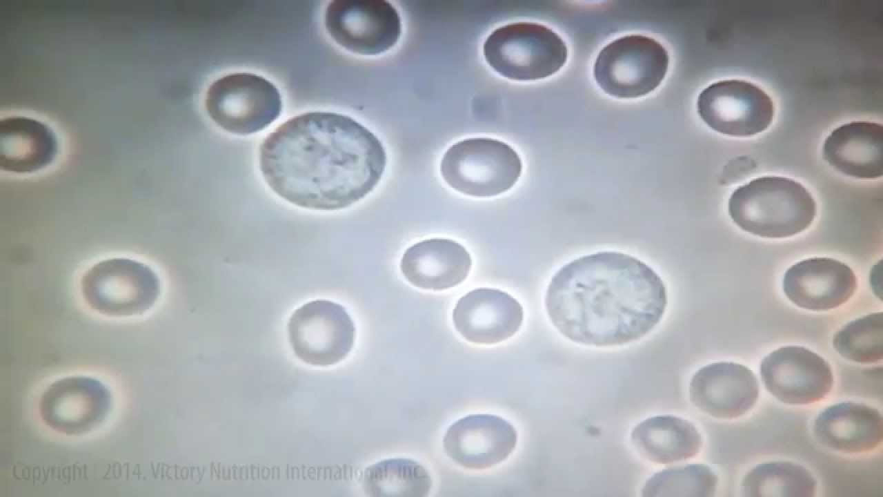 Big Pharma’s Met its Match: 100% Proof This Antidote Will Change Your Blood—You’ll Never Be the Same Big Pharma’s Met its Match: 100% Proof This Antidote Will Change Your Blood—You’ll Never Be the Same