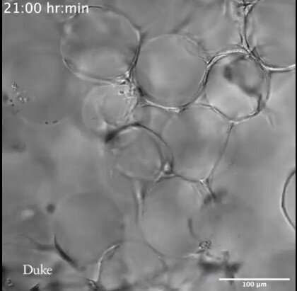 Watching primordial neural cells grow in 3D scaffolds to heal brain injury