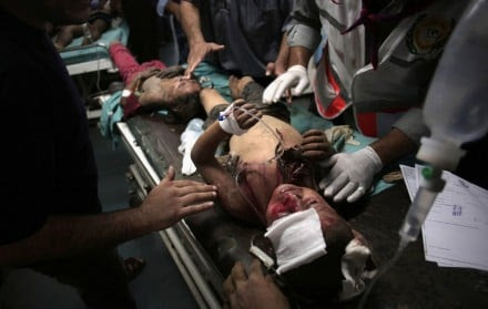 Niños heridos tras los bombardeos en Franja de Gaza. Foto: AP / Khalil Hamra