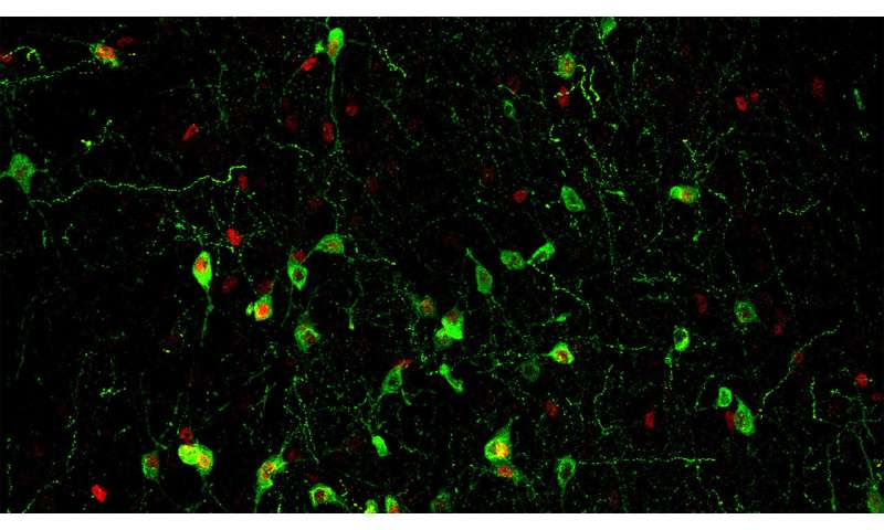 The neurons that connect stress, insomnia, and the immune system