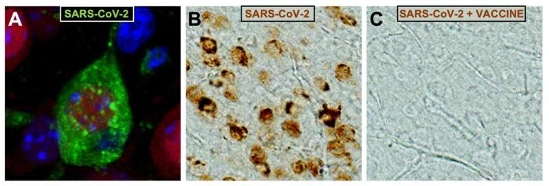 A CSIC vaccine against COVID-19 protects against infection and brain damage caused by the virus