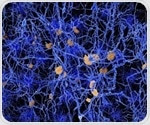 Alzheimer's disease also affects small blood vessels