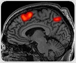 Study shows link between epilepsy and structural differences in grey matter