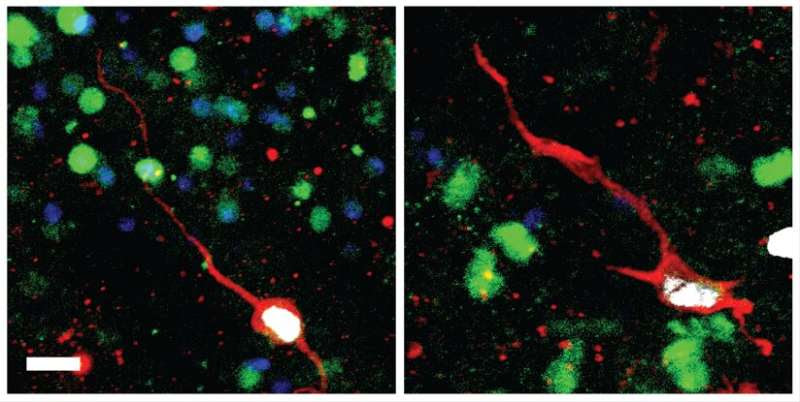 Discovery of molecular signatures of immature neurons in human brain throughout life provide new insights into brain plasticity