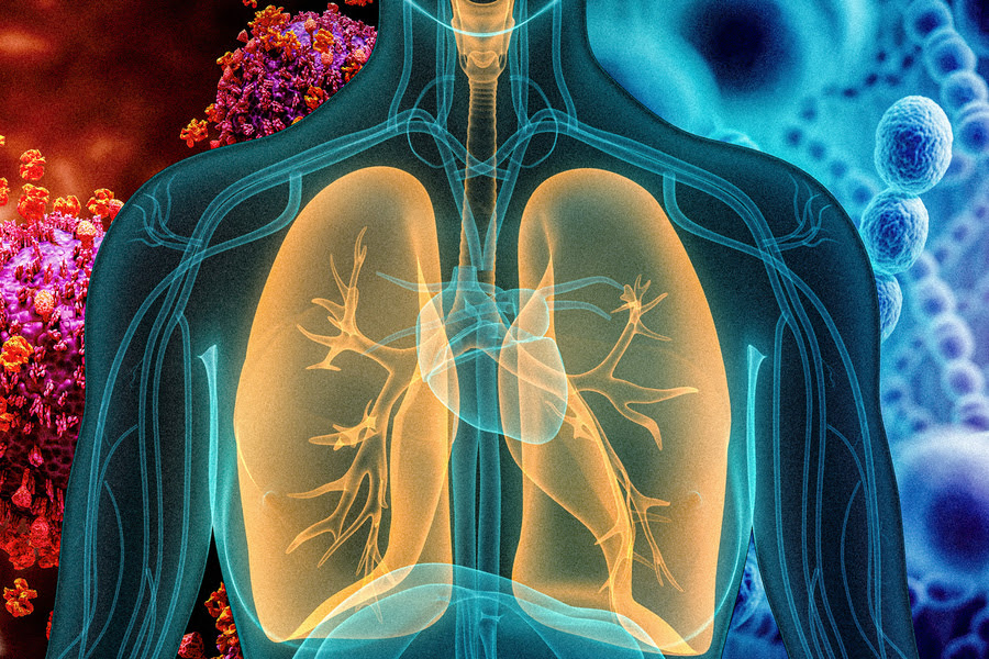 chest x ray graphic with pneumonia virus in background