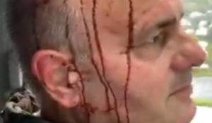 Norway: Muslim mob beats critic of Islam for saying Muhammad was a false prophet