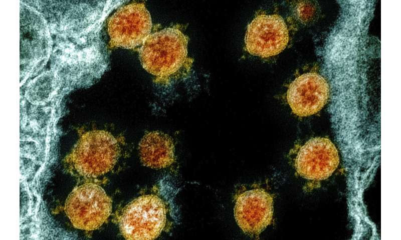 Scientists say Hong Kong man got coronavirus a second time