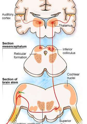 Beckman neuroscientists uncover neuronal circuitry controlling auditory sensory perception