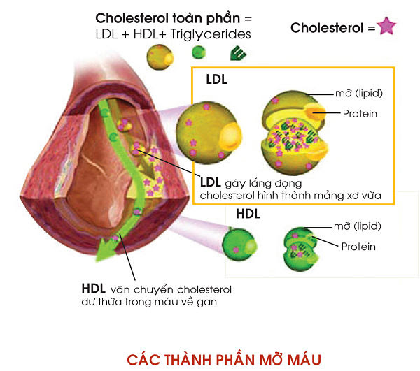 cholesterol là gì, cholesterol la gi, cholesterol cao