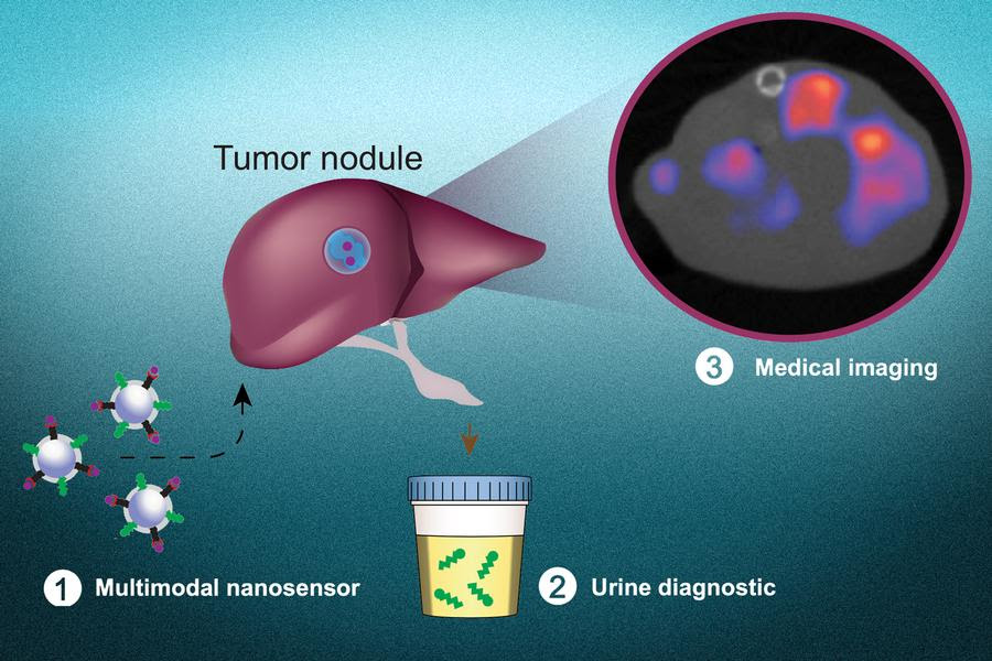 A diagram demonstrating how the cancer diagnosing nanoparticles might work