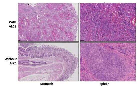 Blocking DNA repair enzyme could help treat certain cancers