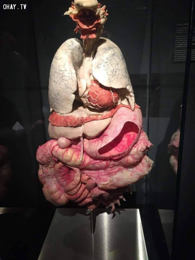 Mô hình chi tiết về nội tạng bên trong cơ thể,cơ thể con người