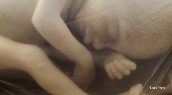 20-week-old-baby-in-utero-preborn.jpg