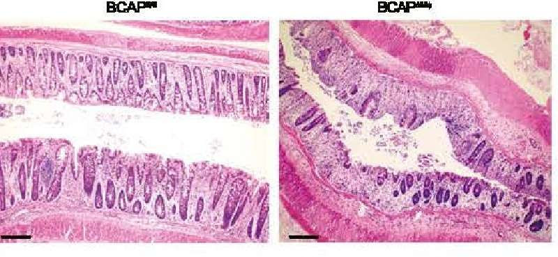 Study pinpoints target for managing inflammation, promoting tissue repair