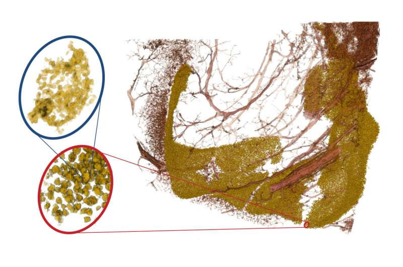 Three-dimensional X-ray image throws light on neurodegenerative disease