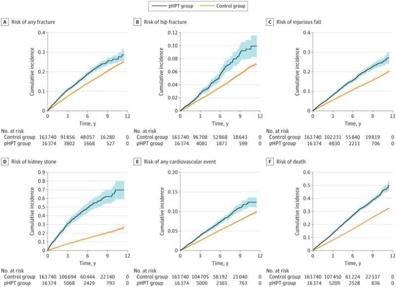 Primary hyperparathyroidism linked to bone fracture, stroke and heart attack