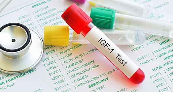 Tube marked IFG-1 Test