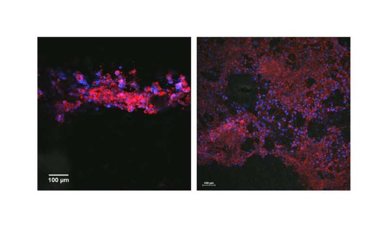 Printable ink guides cell growth, offers nerve injury hope