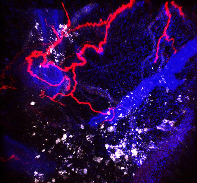 Nerves (in red) embedded in the breast tumor (white) of a mouse.