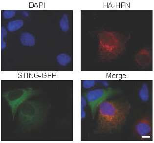 A turncoat protein allows viruses to ride roughshod in the liver, paving the way to cancer