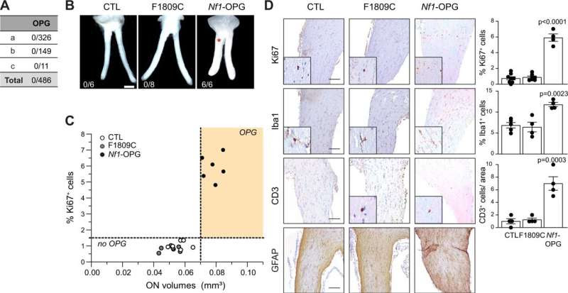 Epilepsy drug stops nervous system tumor growth in mice