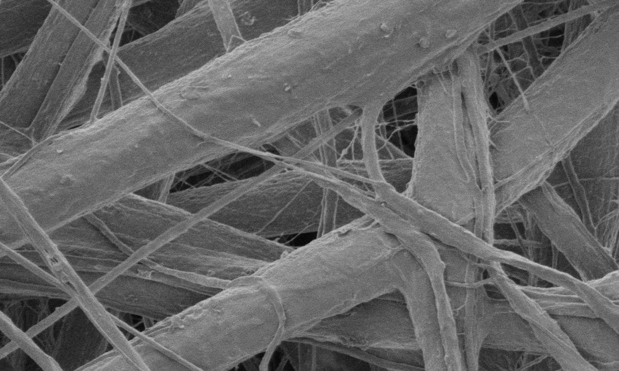 A microscope image of the bandage's magnesium-hydroxide-coated fibers