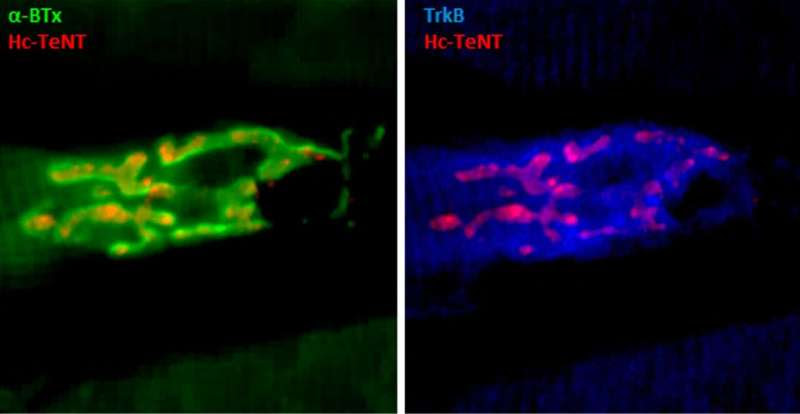 Tetanus toxin fragment may treat depression, Parkinson’s disease and ALS